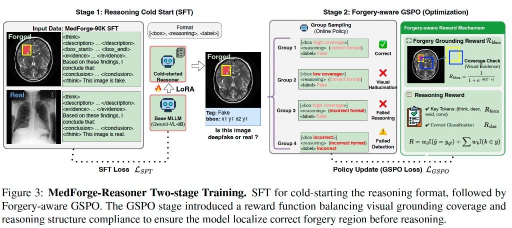 MedForge-Reasoner two-stage training with SFT and Forgery-aware GSPO